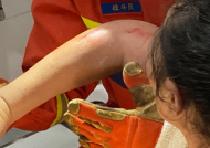 南昌一女子捡肥皂手卡便池 消防员破拆救援